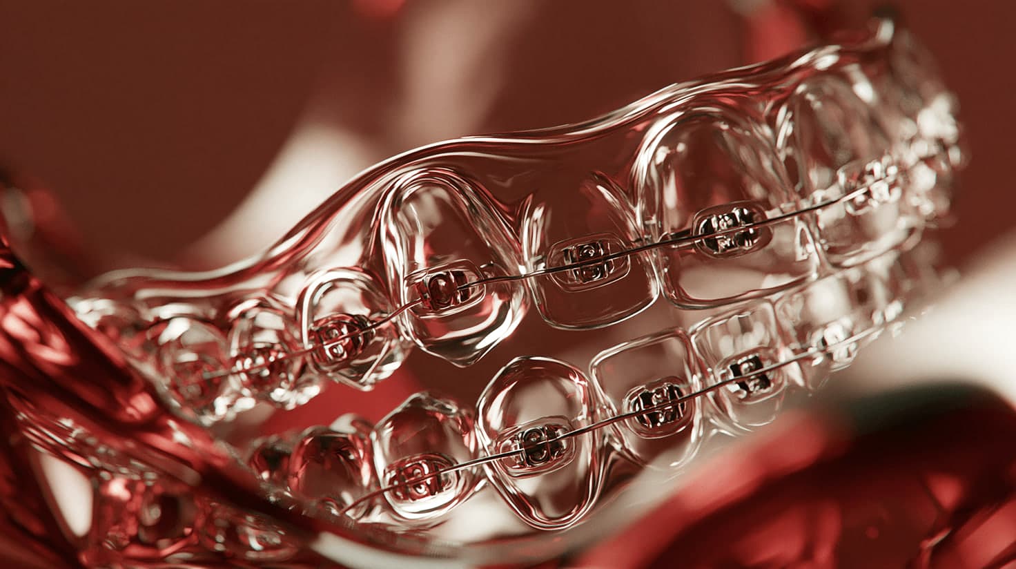 Crystal teeth with metal braces in burgundy light